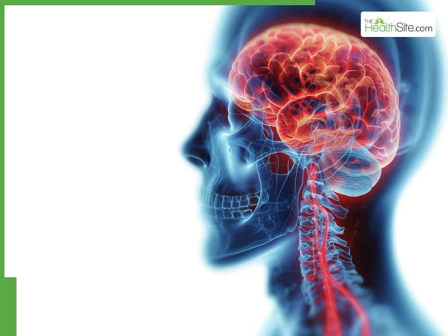 Handicaps neurologiques : troubles courants et traitement